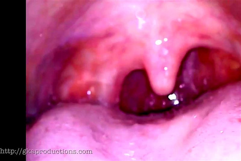 Watch Incredible Mouth Inspection With Whitney Morgan